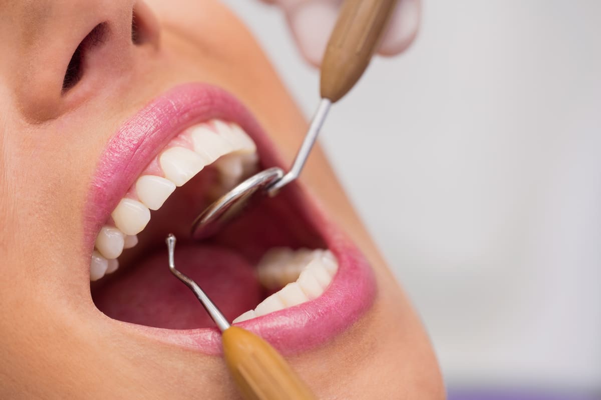 Mulher sendo examinada em consultório odontológico para saber como tirar a cárie do dente.